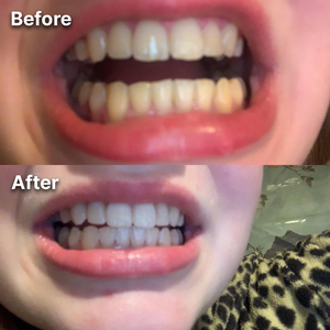 Customer review photo