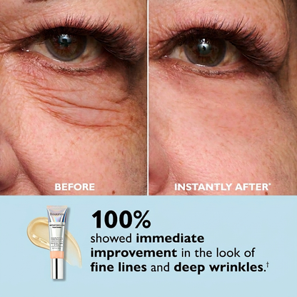 Busauruss™ Instant Face Temporary Tightener – Instant visible results in 60 seconds